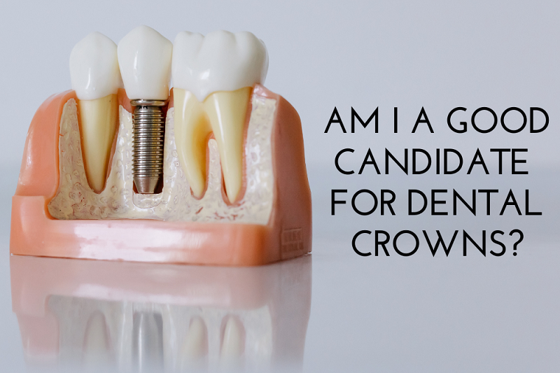 Am I A Good Candidate For Dental Crowns